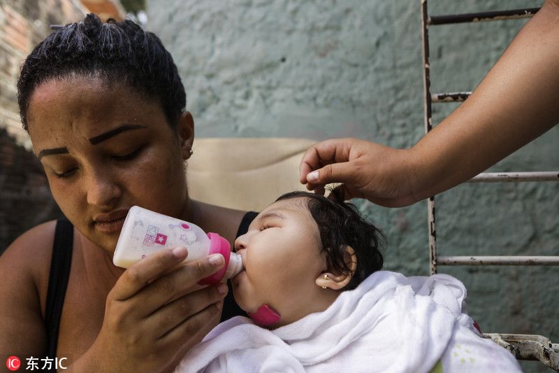 巴西寨卡阴影:贫民窟宝宝生命受小头症侵蚀
