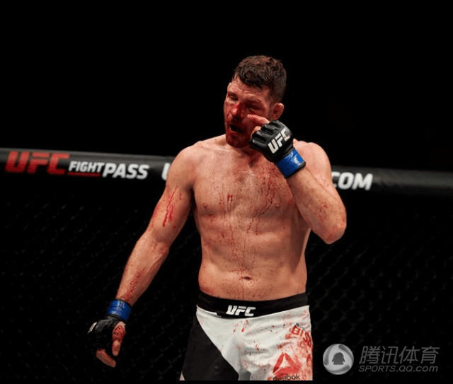 组图：UFC被称为最为血腥的比赛 原因竟在这(12) 第12页