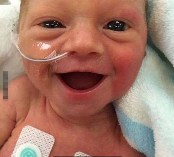 早产婴儿刚出生不久的暖心笑容，巨大感染力会让你也会忍不住微笑 第1页