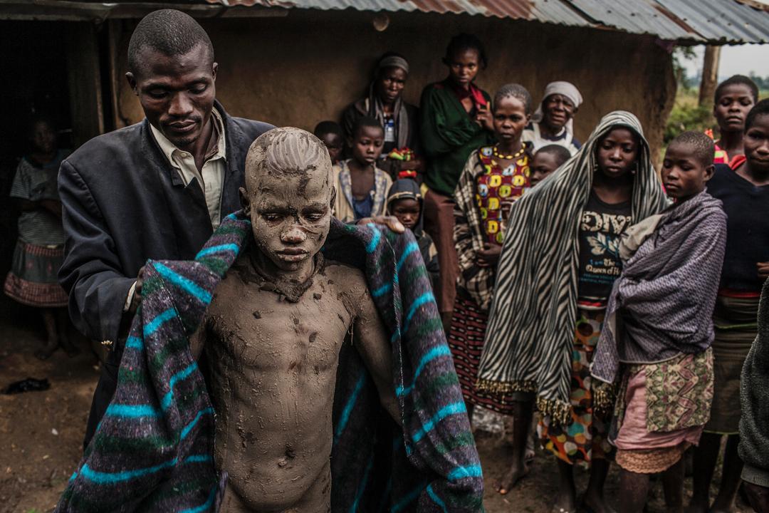 奖项:年度摄影师一等奖获奖者:pete muller 图为非洲,sadik接受割礼后